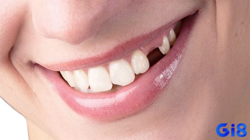 Giấc mơ thấy rụng răng có ý nghĩa liên quan đến sự quyết đoán cũng như sức mạnh nội tại bản thân