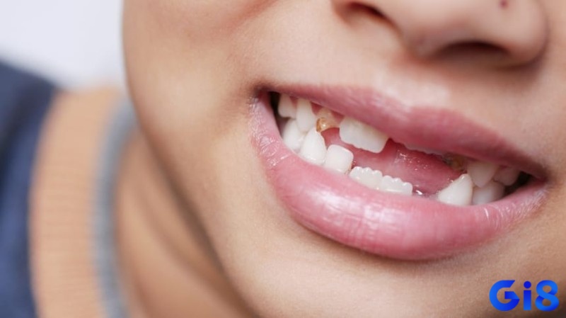 Giải mã giấc mơ thấy rụng răng mang đến cho bạn nhiều con số may mắn mỗi ngày