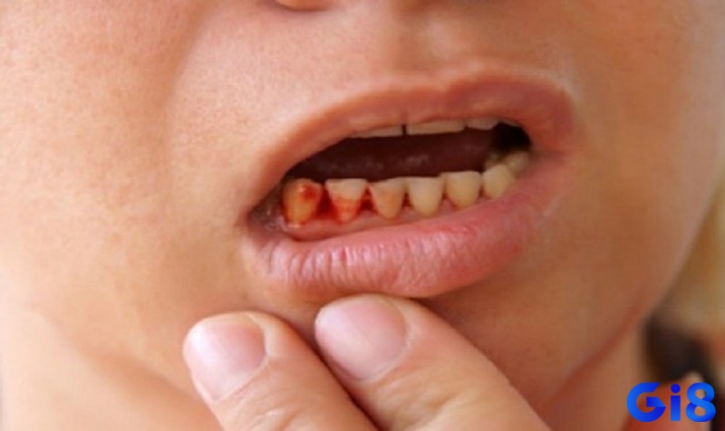 Giải mã giấc mơ thấy mình tự nhổ răng và chảy rất nhiều máu là thiên về sự tiêu hao năng lượng